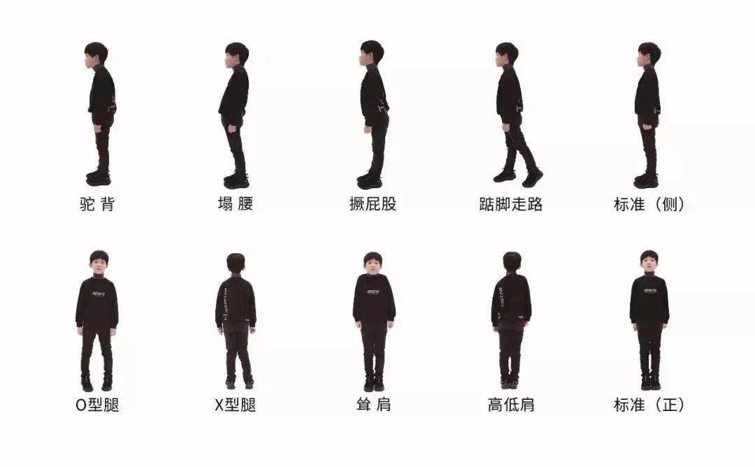 少儿模特，童模为什么会驼背？